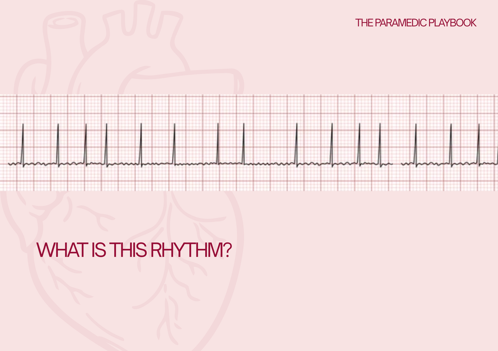 ECG Basic Flashcard set x10 rhythms