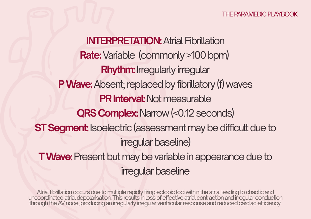 ECG Basic Flashcard set x10 rhythms
