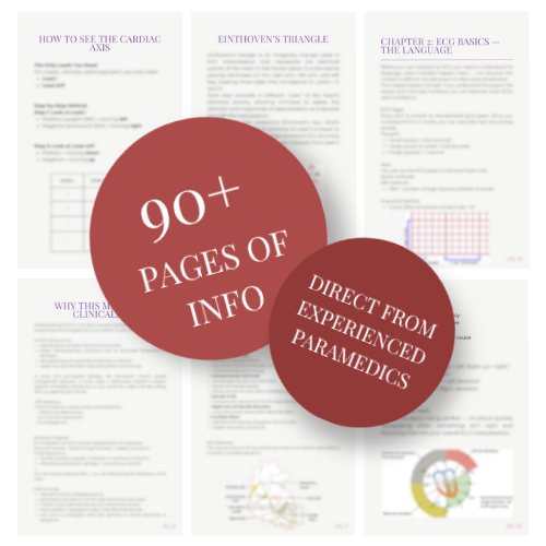 ECG ultimate bundle - Ebook / flashcards/sticker