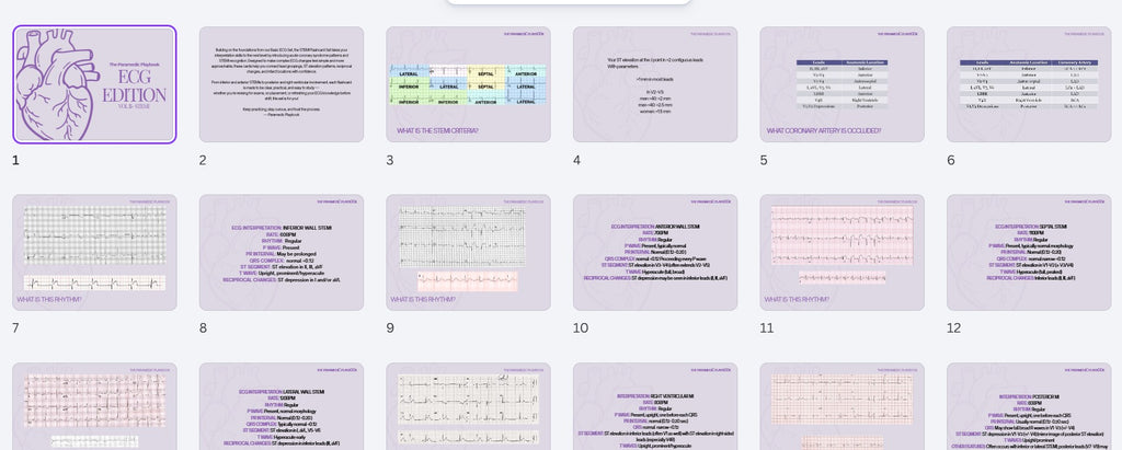 ECG STEMI Flashcard set x10 rhythms